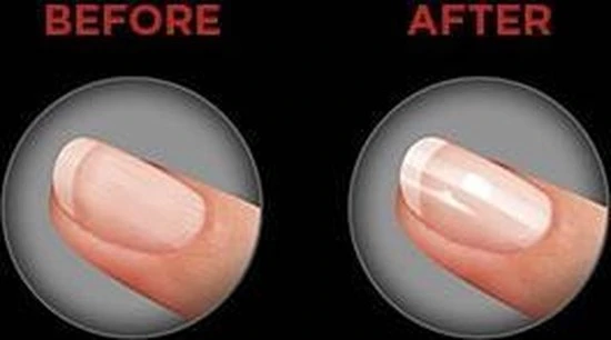 Revlon RVSP3525UKE - Nagel Buffer - Image 3