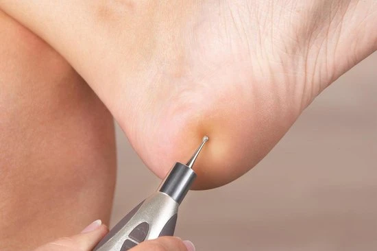 Beurer MP60 - Manicure/pedicureset - 9 Opzetstukken - Semi Professioneel - Image 21