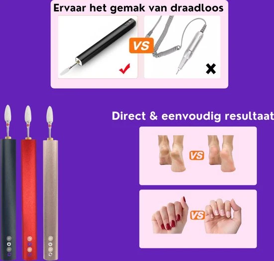 V&M Beauty- Nagelfrees - Elektrische Nagelvijl - Draadloos - Accu- Inclusief Opzetstukjes En Schuurrolletjes- Ros?goud - Image 3