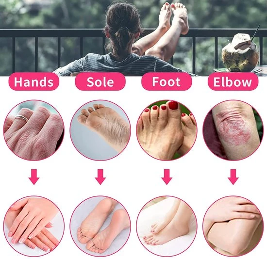 AYITOO Paraffinebaden Waxbad 265 W Voor Handen En Voeten Met Accessoires, Elektrisch Waxbad Met Paraffinewas, Paraffine Wasbad Voor Handen En Voeten Apparaat Roze - Image 5