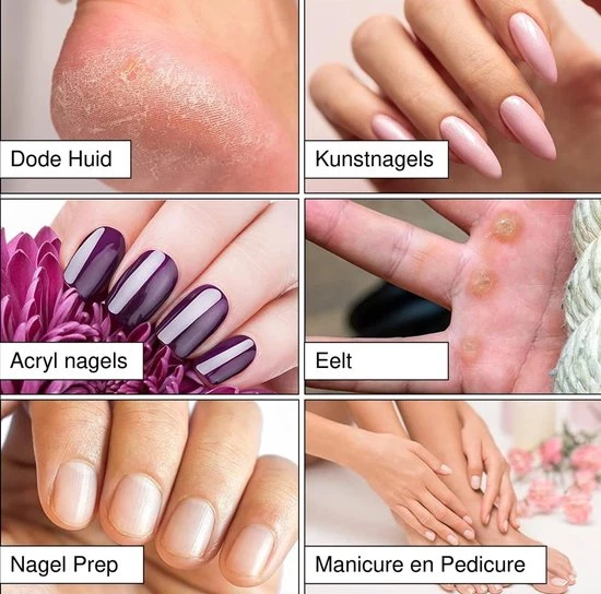 Merkloos Schuurrolletjes Nagelfrees - 100/180/240 Grit - 300 Stuks - Schuurrolletjes - Schuurrollen - Schuurrolletjes 100 - Schuurrolletjes 180 Grit - Schuurrolletjes 240 Grit - Schuurhulzen - Mandrel Bitjes - Sanding Bands Nagels - Sanding Bands Nails - Image 8