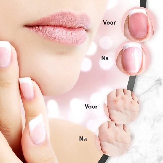 ProductPlanet Premium Elektrische Nagelvijl Set 2022 - Nagelvijl Electrisch - Manicure En Pedicure Set - Electrische Nagelvijl - 60 Schuurrolletjes & 11 NagelFrees Bitjes - Groen - Image 4