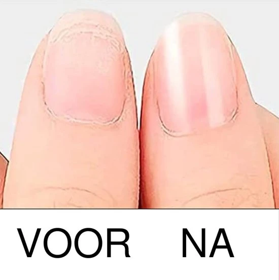 Merkloos Schuurrolletjes Nagelfrees - 100/180/240 Grit - 300 Stuks - Schuurrolletjes - Schuurrollen - Schuurrolletjes 100 - Schuurrolletjes 180 Grit - Schuurrolletjes 240 Grit - Schuurhulzen - Mandrel Bitjes - Sanding Bands Nagels - Sanding Bands Nails - Image 10